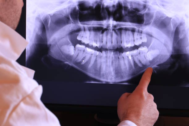 Best Same-Day Emergency Dentist in Barnesville, GA