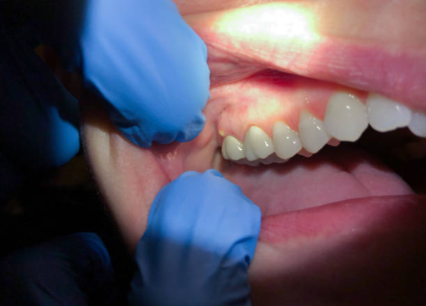 Best Emergency Dental Care for Trauma or Injury in Barnesville, GA